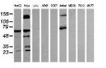 TRMT2A Antibody in Western Blot (WB)