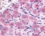 TRPA1 Antibody in Immunohistochemistry (Paraffin) (IHC (P))