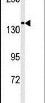 TRPM7 Antibody in Western Blot (WB)