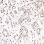 TReP-132/TRERF1 Antibody in Immunohistochemistry (IHC)