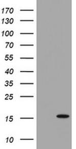 TSC22D3 Antibody in Western Blot (WB)