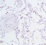 Nkx2.1 Antibody in Immunohistochemistry (IHC)