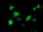 TTLL12 Antibody in Immunocytochemistry (ICC/IF)