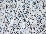 TTLL12 Antibody in Immunohistochemistry (Paraffin) (IHC (P))