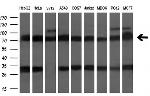 TTLL12 Antibody in Western Blot (WB)