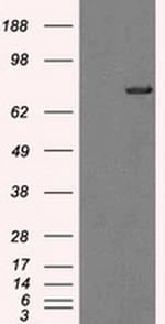 TTLL12 Antibody in Western Blot (WB)