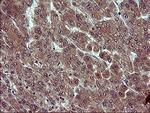 TUBA1B Antibody in Immunohistochemistry (Paraffin) (IHC (P))