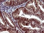 TUBB1 Antibody in Immunohistochemistry (Paraffin) (IHC (P))