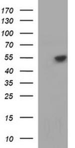 TUBB1 Antibody in Western Blot (WB)