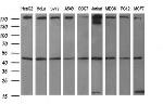 TUBB1 Antibody in Western Blot (WB)