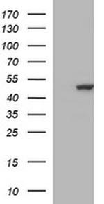 TUBB2B Antibody in Western Blot (WB)