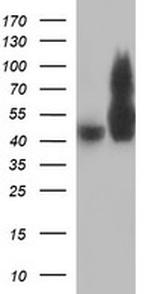 TUBB2B Antibody in Western Blot (WB)