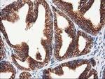 TUBB4 Antibody in Immunohistochemistry (Paraffin) (IHC (P))