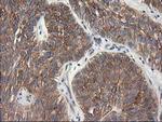 TUBB4 Antibody in Immunohistochemistry (Paraffin) (IHC (P))