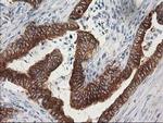 TUBB4 Antibody in Immunohistochemistry (Paraffin) (IHC (P))