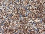 TUBB4 Antibody in Immunohistochemistry (Paraffin) (IHC (P))