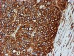 TUBB4 Antibody in Immunohistochemistry (Paraffin) (IHC (P))