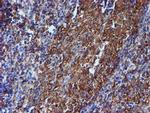 TUBB4 Antibody in Immunohistochemistry (Paraffin) (IHC (P))