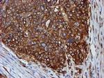 TUBB4 Antibody in Immunohistochemistry (Paraffin) (IHC (P))