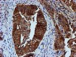 TUBB4 Antibody in Immunohistochemistry (Paraffin) (IHC (P))