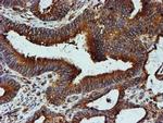 TUBB4 Antibody in Immunohistochemistry (Paraffin) (IHC (P))