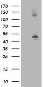 TUBB4 Antibody in Western Blot (WB)