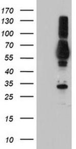 TULP3 Antibody in Western Blot (WB)