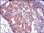 PTK9 Antibody in Immunohistochemistry (Paraffin) (IHC (P))