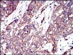 PTK9 Antibody in Immunohistochemistry (Paraffin) (IHC (P))