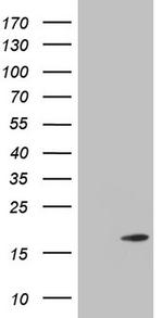 TWIST2 Antibody in Western Blot (WB)