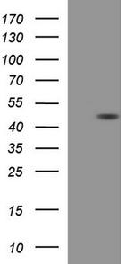 TXNDC5 Antibody in Western Blot (WB)