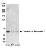 Thioredoxin Reductase 1/TXNRD1/TRXR1 Antibody in Western Blot (WB)