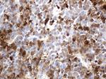 TYMP Antibody in Immunohistochemistry (Paraffin) (IHC (P))