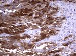 TYMS Antibody in Immunohistochemistry (Paraffin) (IHC (P))