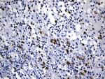 TYMS Antibody in Immunohistochemistry (Paraffin) (IHC (P))