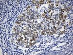 TYMS Antibody in Immunohistochemistry (Paraffin) (IHC (P))