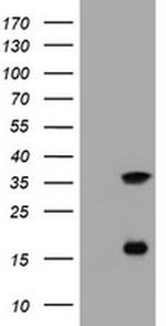 TYMS Antibody in Western Blot (WB)