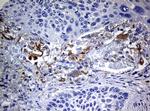 TYR Antibody in Immunohistochemistry (Paraffin) (IHC (P))