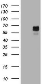 TYR Antibody in Western Blot (WB)