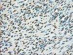 TYRO3 Antibody in Immunohistochemistry (Paraffin) (IHC (P))