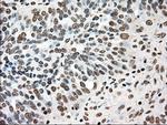 TYRO3 Antibody in Immunohistochemistry (Paraffin) (IHC (P))