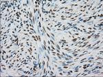 TYRO3 Antibody in Immunohistochemistry (Paraffin) (IHC (P))