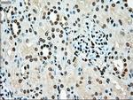 TYRO3 Antibody in Immunohistochemistry (Paraffin) (IHC (P))