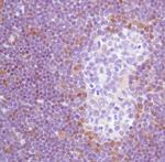 TdT Antibody in Immunohistochemistry (IHC)