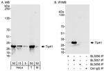 Tip41 Antibody in Western Blot (WB)