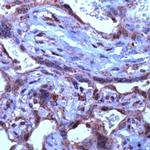 TGF beta-3 Antibody in Immunohistochemistry (IHC)