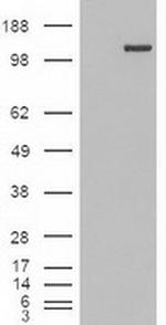 Trim33 Antibody in Western Blot (WB)