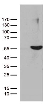 UBA3 Antibody in Western Blot (WB)