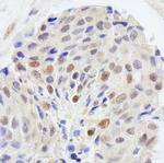 UBE1 Antibody in Immunohistochemistry (IHC)