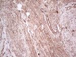 UBE2D2 Antibody in Immunohistochemistry (Paraffin) (IHC (P))